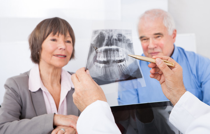 Benefits of Dental Implants